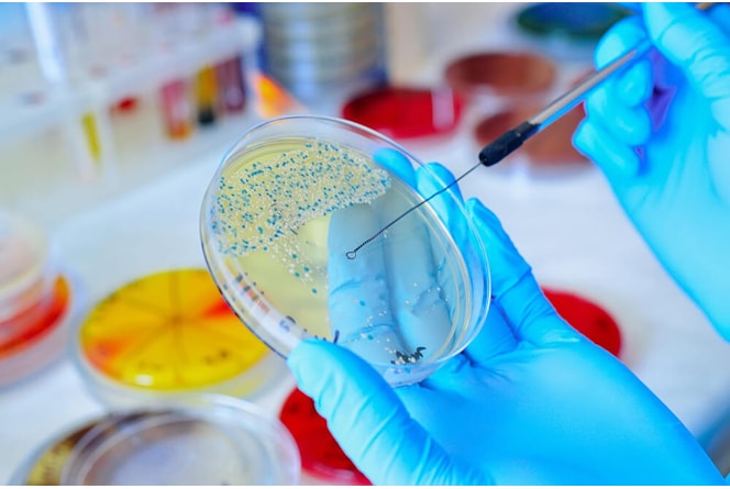 Cultura E Antibiograma - Secrecao Orofaringe